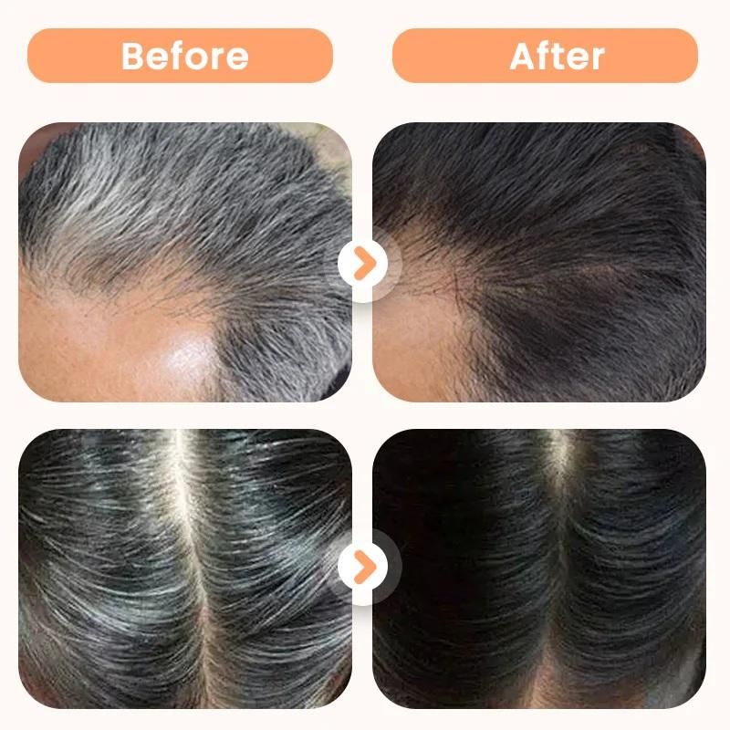 Plant Extract Hair Dye for Gray Hair 200 ml (Pack of 1)