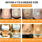 Bee Venom Slimming Patches (Pack of 10)